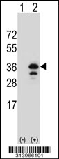 Western blot analysis of his-tag METTL1 (arrow) using his tag antibody. 293 cell lysates (2 ug/lane) either nontransfected (Lane 1) or transiently transfected with the METTL1 gene.