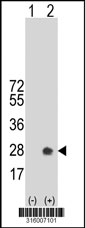 Western blot analysis of his-tag PFDN5 (arrow) using his tag antibody. 293T cell lysates (2 ug/lane) either nontransfected (Lane 1) or transiently transfected with the PFDN5 gene‘