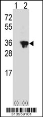 Western blot analysis of his-tag HCCS (arrow) using his tag antibody. 293 cell lysates (2 ug/lane) either nontransfected (Lane 1) or transiently transfected with the HCCS gene.