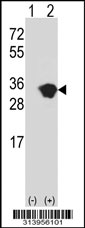 Western blot analysis of his-tag PGAM2 (arrow) using his tag antibody. 293 cell lysates (2 ug/lane) either nontransfected (Lane 1) or transiently transfected with the PGAM2 gene.