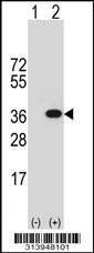 Western blot analysis of his-tag ATP6V1D (arrow) using his tag antibody. 293 cell lysates (2 ug/lane) either nontransfected (Lane 1) or transiently transfected with the ATP6V1D gene.
