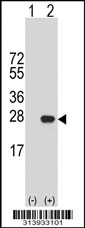 Western blot analysis of his-tag FGF19 (arrow) using his tag antibody. 293 cell lysates (2 ug/lane) either nontransfected (Lane 1) or transiently transfected with the FGF19 gene.