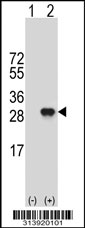 Western blot analysis of his-tag AKIRIN2 (arrow) using his tag antibody. 293 cell lysates (2 ug/lane) either nontransfected (Lane 1) or transiently transfected with the AKIRIN2 gene.