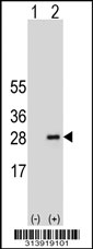 Western blot analysis of his-tag RPL13A (arrow) using his tag antibody. 293 cell lysates (2 ug/lane) either nontransfected (Lane 1) or transiently transfected with the RPL13A gene.