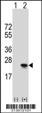 Western blot analysis of his-tag TNFAIP8 (arrow) using his tag antibody. 293 cell lysates (2 ug/lane) either nontransfected (Lane 1) or transiently transfected with the TNFAIP8 gene.