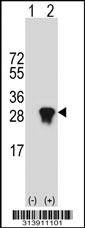 Western blot analysis of his-tag UBE2T (arrow) using his tag antibody. 293 cell lysates (2 ug/lane) either nontransfected (Lane 1) or transiently transfected with the UBE2T gene.
