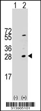 Western blot analysis of his-tag SNRPB2 (arrow) using his tag antibody. 293 cell lysates (2 ug/lane) either nontransfected (Lane 1) or transiently transfected with the SNRPB2 gene.