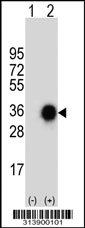 Western blot analysis of his-tag CHMP2A (arrow) using his tag antibody. 293 cell lysates (2 ug/lane) either nontransfected (Lane 1) or transiently transfected with the CHMP2A gene
