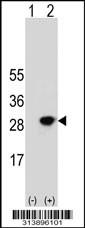 Western blot analysis of his-tag EIF3K (arrow) using his tag antibody. 293 cell lysates (2 ug/lane) either nontransfected (Lane 1) or transiently transfected with the EIF3K gene