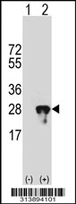 Western blot analysis of his-tag CYGB (arrow) using his tag antibody. 293 cell lysates (2 ug/lane) either nontransfected (Lane 1) or transiently transfected with the CYGB gene.