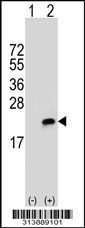 Western blot analysis of his-tag IL1F5 (arrow) using his tag antibody. 293 cell lysates (2 ug/lane) either nontransfected (Lane 1) or transiently transfected with the IL1F5 gene