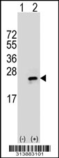 Western blot analysis of his-tag FAM107A (arrow) using his tag antibody. 293 cell lysates (2 ug/lane) either nontransfected (Lane 1) or transiently transfected with the FAM107A gene
