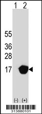 Western blot analysis of his-tag C14orf1 (arrow) using his tag antibody. 293 cell lysates (2 ug/lane) either nontransfected (Lane 1) or transiently transfected with the C14orf1 gene