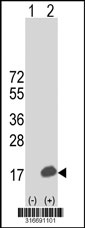 Western blot analysis of his-tag LOC203547 (arrow) using his tag antibody. 293T cell lysates (2 ug/lane) either nontransfected (Lane 1) or transiently transfected with the LOC203547 gene‘