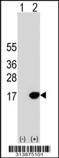 Western blot analysis of his-tag TRAPPC2L (arrow) using his tag antibody. 293 cell lysates (2 ug/lane) either nontransfected (Lane 1) or transiently transfected with the TRAPPC2L gene