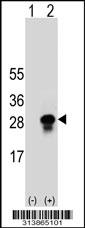 Western blot analysis of his-tag GINS2 (arrow) using his tag antibody. 293 cell lysates (2 ug/lane) either nontransfected (Lane 1) or transiently transfected with the GINS2 gene