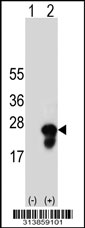 Western blot analysis of his-tag ADI1 (arrow) using his tag antibody. 293 cell lysates (2 ug/lane) either nontransfected (Lane 1) or transiently transfected with the ADI1 gene