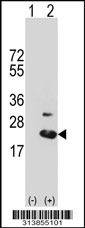 Western blot analysis of his-tag DCTN3 (arrow) using his tag antibody. 293 cell lysates (2 ug/lane) either nontransfected (Lane 1) or transiently transfected with the DCTN3 gene.