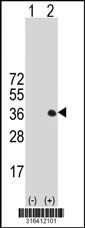 Western blot analysis of his-tag PRTN3 (arrow) using his tag antibody. 293T cell lysates (2 ug/lane) either nontransfected (Lane 1) or transiently transfected with the PRTN3 gene‘