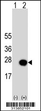 Western blot analysis of his-tag CYTH3 (arrow) using his tag antibody. 293 cell lysates (2 ug/lane) either nontransfected (Lane 1) or transiently transfected with the CYTH3 gene