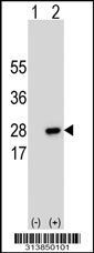 Western blot analysis of his-tag TRAPPC6A (arrow) using his tag antibody. 293 cell lysates (2 ug/lane) either nontransfected (Lane 1) or transiently transfected with the TRAPPC6A gene