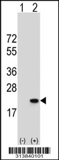 Western blot analysis of his-tag GADD45G (arrow) using his tag antibody. 293 cell lysates (2 ug/lane) either nontransfected (Lane 1) or transiently transfected with the GADD45G gene