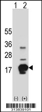 Western blot analysis of his-tag IFITM1 (arrow) using his tag antibody. 293 cell lysates (2 ug/lane) either nontransfected (Lane 1) or transiently transfected with the IFITM1 gene
