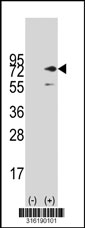 Western blot analysis of his-tag SGSM3 (arrow) using his tag antibody. 293T cell lysates (2 ug/lane) either nontransfected (Lane 1) or transiently transfected with the SGSM3 gene‘