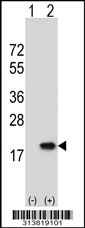 Western blot analysis of his-tag PFDN2 (arrow) using his tag antibody. 293 cell lysates (2 ug/lane) either nontransfected (Lane 1) or transiently transfected with the PFDN2 gene