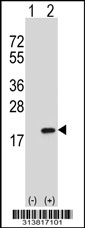 Western blot analysis of his-tag TAC1 (arrow) using his tag antibody. 293 cell lysates (2 ug/lane) either nontransfected (Lane 1) or transiently transfected with the TAC1 gene