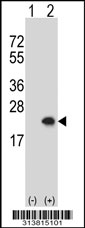 Western blot analysis of his-tag BEX2 (arrow) using his tag antibody. 293 cell lysates (2 ug/lane) either nontransfected (Lane 1) or transiently transfected with the BEX2 gene