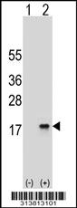 Western blot analysis of his-tag RBX1 (arrow) using his tag antibody. 293 cell lysates (2 ug/lane) either nontransfected (Lane 1) or transiently transfected with the RBX1 gene