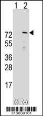 Western blot analysis of his-tag JMJD1B (arrow) using his tag antibody. 293 cell lysates (2 ug/lane) either nontransfected (Lane 1) or transiently transfected with the JMJD1B gene