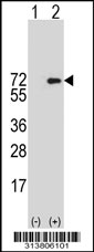 Western blot analysis of his-tag PLOD2 (arrow) using his tag antibody. 293 cell lysates (2 ug/lane) either nontransfected (Lane 1) or transiently transfected with the PLOD2 gene