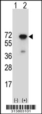 Western blot analysis of his-tag CARS (arrow) using his tag antibody. 293 cell lysates (2 ug/lane) either nontransfected (Lane 1) or transiently transfected with the CARS gene