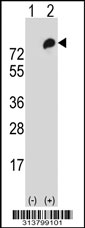 Western blot analysis of his-tag AFAP1 (arrow) using his tag antibody. 293 cell lysates (2 ug/lane) either nontransfected (Lane 1) or transiently transfected with the AFAP1 gene.