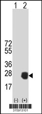Western blot analysis of his-tag VGLL2 (arrow) using his tag antibody. 293T cell lysates (2 ug/lane) either nontransfected (Lane 1) or transiently transfected with the VGLL2 gene‘