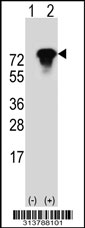 Western blot analysis of his-tag CALCOCO1 (arrow) using his tag antibody. 293 cell lysates (2 ug/lane) either nontransfected (Lane 1) or transiently transfected with the CALCOCO1 gene