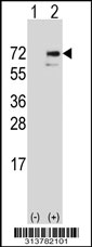 Western blot analysis of his-tag COL4A3BP (arrow) using his tag antibody. 293 cell lysates (2 ug/lane) either nontransfected (Lane 1) or transiently transfected with the COL4A3BP gene