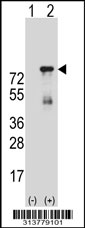 Western blot analysis of his-tag PAF1 (arrow) using his tag antibody. 293 cell lysates (2 ug/lane) either nontransfected (Lane 1) or transiently transfected with the PAF1 gene