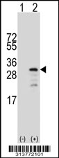 Western blot analysis of his-tag AGPAT2 (arrow) using his tag antibody. 293 cell lysates (2 ug/lane) either nontransfected (Lane 1) or transiently transfected with the AGPAT2 gene