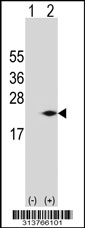 Western blot analysis of his-tag CALN1 (arrow) using his tag antibody. 293 cell lysates (2 ug/lane) either nontransfected (Lane 1) or transiently transfected with the CALN1 gene