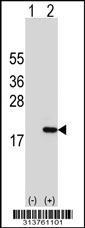 Western blot analysis of his-tag C15orf40 (arrow) using his tag antibody. 293 cell lysates (2 ug/lane) either nontransfected (Lane 1) or transiently transfected with the C15orf40 gene