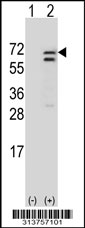 Western blot analysis of his-tag RARS (arrow) using his tag antibody. 293 cell lysates (2 ug/lane) either nontransfected (Lane 1) or transiently transfected with the RARS gene
