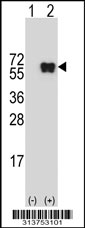 Western blot analysis of his-tag DDX17 (arrow) using his tag antibody. 293 cell lysates (2 ug/lane) either nontransfected (Lane 1) or transiently transfected with the DDX17 gene