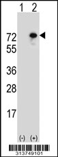 Western blot analysis of his-tag ZNF133 (arrow) using his tag antibody. 293 cell lysates (2 ug/lane) either nontransfected (Lane 1) or transiently transfected with the ZNF133 gene.