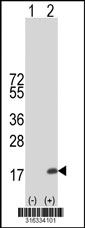 Western blot analysis of his-tag SPACA3 (arrow) using his tag antibody. 293T cell lysates (2 ug/lane) either nontransfected (Lane 1) or transiently transfected with the SPACA3 gene‘