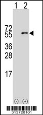 Western blot analysis of his-tag UMPS (arrow) using his tag antibody. 293 cell lysates (2 ug/lane) either nontransfected (Lane 1) or transiently transfected with the UMPS gene