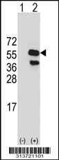 Western blot analysis of his-tag TRAF4 (arrow) using his tag antibody. 293 cell lysates (2 ug/lane) either nontransfected (Lane 1) or transiently transfected with the TRAF4 gene