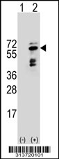 Western blot analysis of his-tag PORCN (arrow) using his tag antibody. 293 cell lysates (2 ug/lane) either nontransfected (Lane 1) or transiently transfected with the PORCN gene